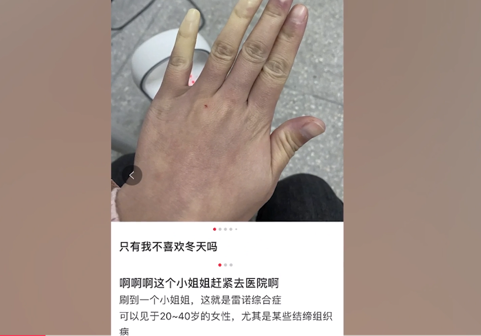 女子晒手脚冰凉照，医学生喊话去医院