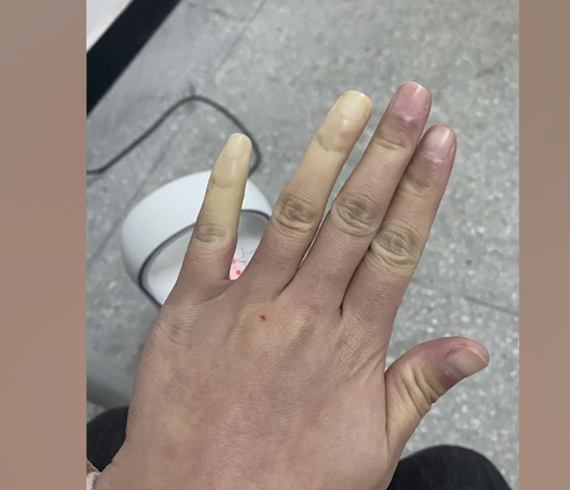 女子晒手脚冰凉照，医学生喊话去医院