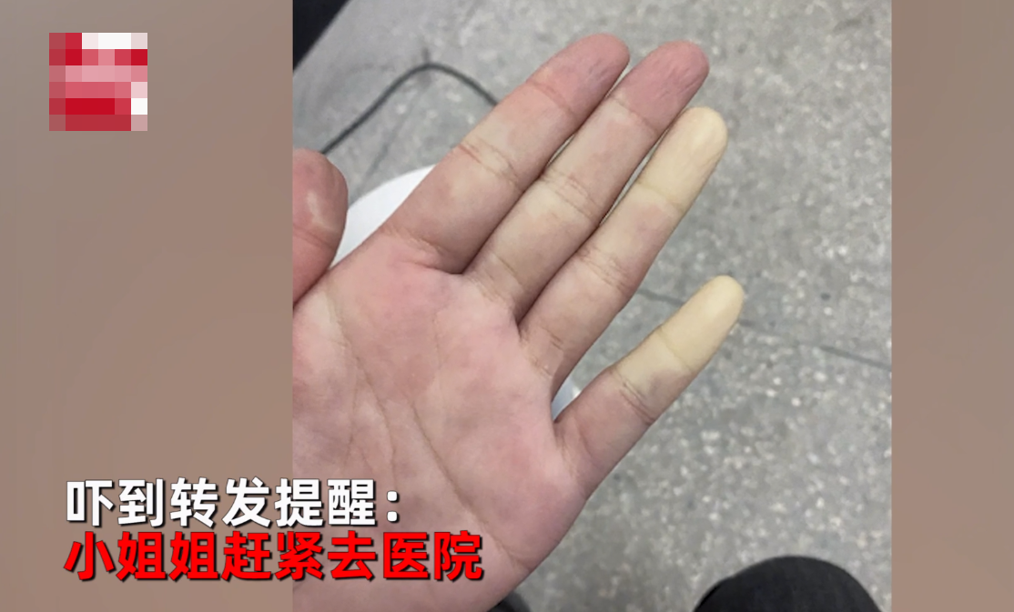 女子晒手脚冰凉照，医学生喊话去医院