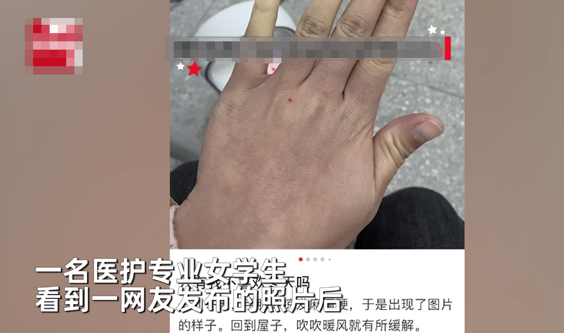 女子晒手脚冰凉照，医学生喊话去医院